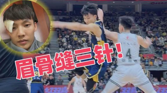  眉骨缝三针！徐杰报平安：新赛季为广东而战